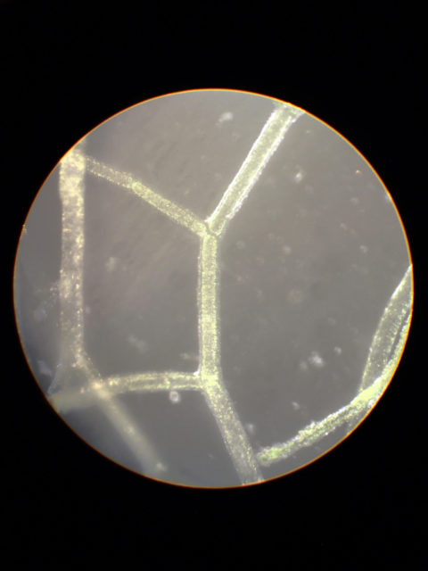 Cladophora Vagabunda, © Hugo Fontes